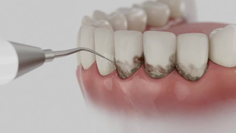 Reliable Dental contractor in Memphis, MO by Dentist Open Now